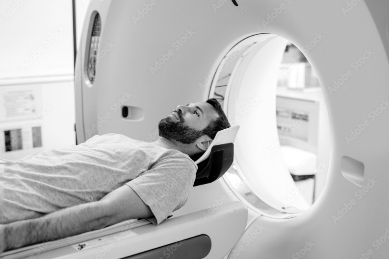 IONIS Alexander Disease Diagnosis