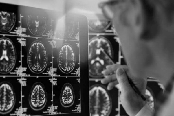 A man reviews a wall of brain scans. [36]